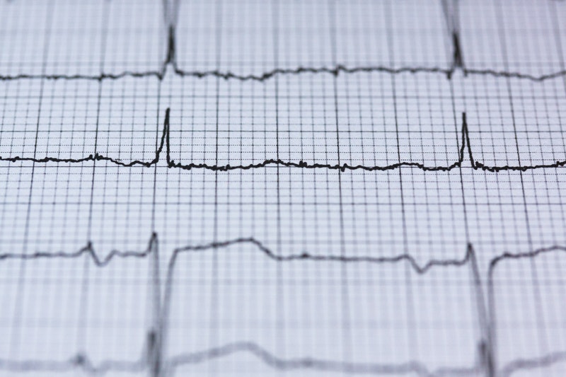 OBS a ryzyko zachorowania na choroby serca